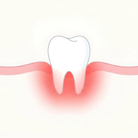 Receding_Gums